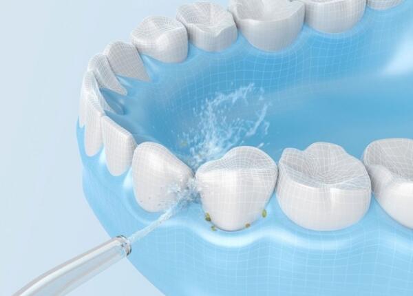 電動(dòng)沖牙器的正確使用方法 電動(dòng)沖牙器的正確使用方法