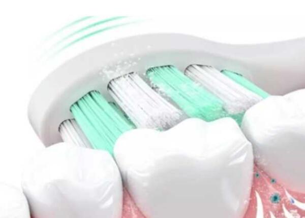 電動(dòng)牙刷如何正確 電動(dòng)牙刷如何正確